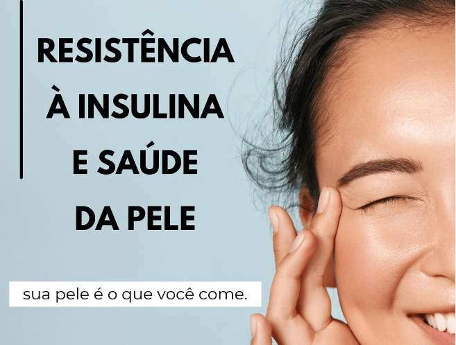 Insulina e saúde da&nbsp;pele